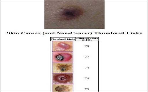 Skin Lesion Image Comparison image